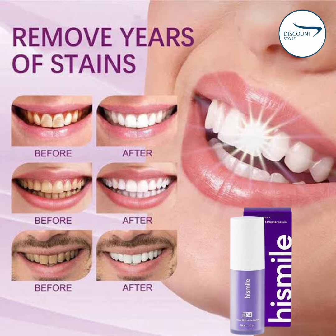 ✨ V34 Teeth Whitening Serum - (IMPORTED)